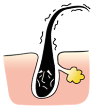 hair root now sticker #226894