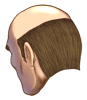 Exciting! Mr. bald head[English version] sticker #462792