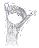 Black cap sticker #6027809