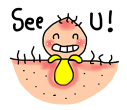 Lovely Pimple V.1 (English) sticker #10013265