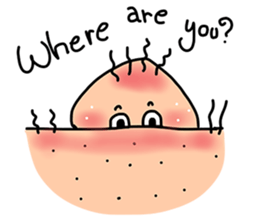 Lovely Pimple V.1 (English) sticker #10013270